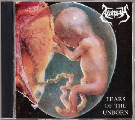 APOPLEXY (SK) Tears of the Unborn / Dysmorphophobia Official CD